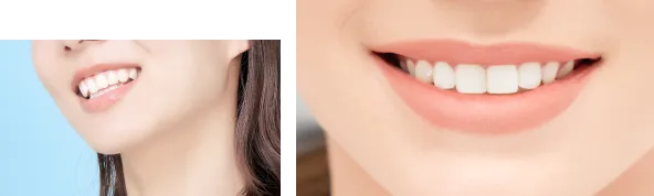ホワイトエッセンスの特徴